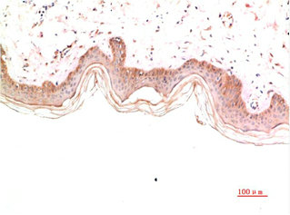 COL4A1 Monoclonal Antibody