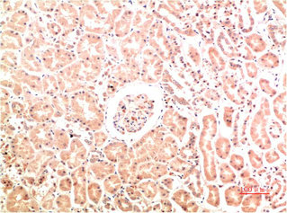 COL4A1 Monoclonal Antibody