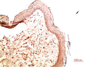COL4A1 Monoclonal Antibody
