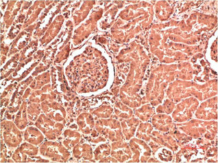 COL4A1 Monoclonal Antibody