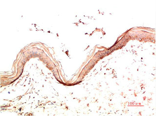 COL4A1 Monoclonal Antibody