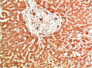 COL4A1 Monoclonal Antibody