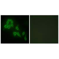 COL5A2 Antibody