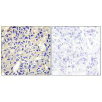 COL5A2 Antibody