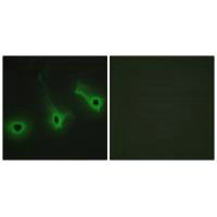 COL5A3 Antibody