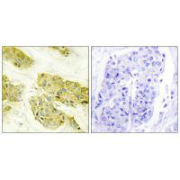 COL5A3 Antibody