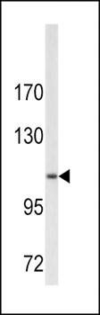 Collagen VI antibody