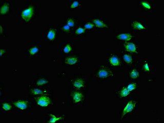 Collagen VIII antibody