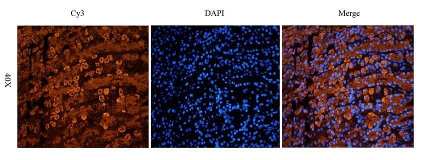 Collagen 4 alpha 1 antibody