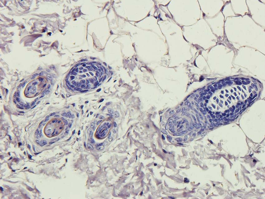 Collagen 4 alpha 1 antibody