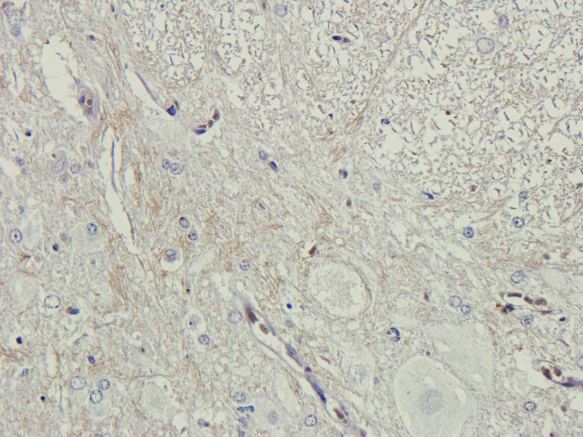 Collagen 4 alpha 1 antibody