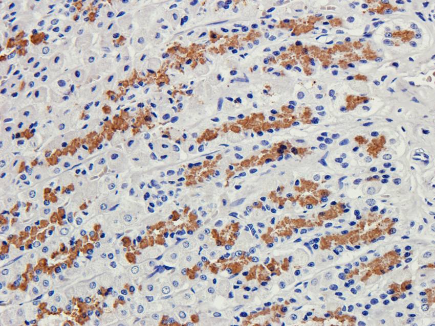 Collagen 4 alpha 1 antibody