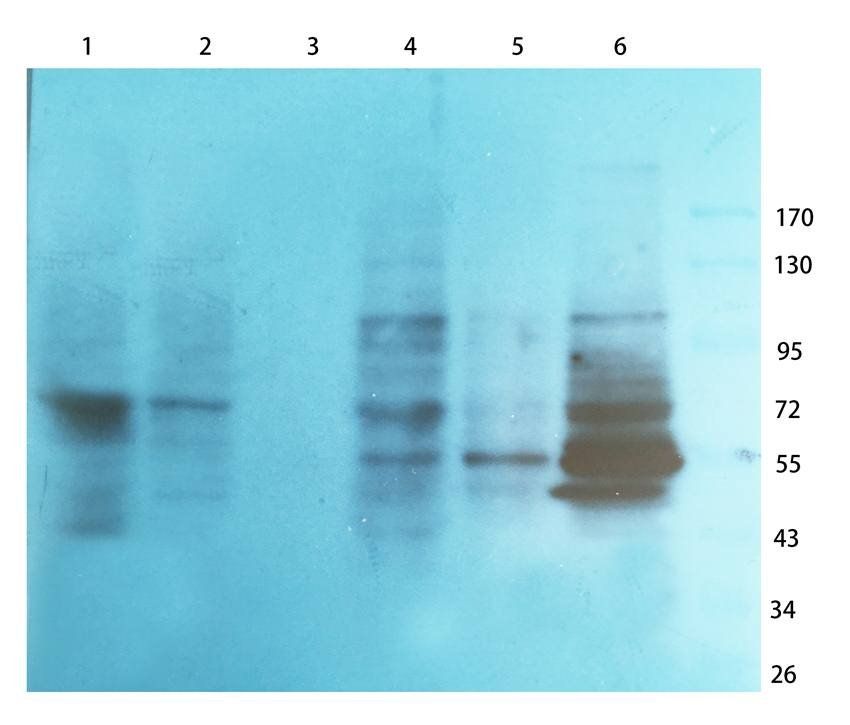 Collagen 4 alpha 1 antibody