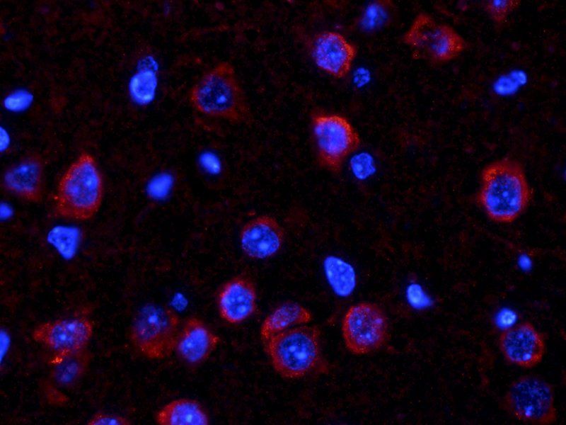 COL2A1 antibody