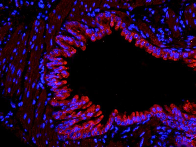 COL2A1 antibody