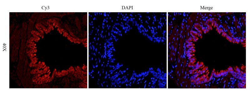 COL2A1 antibody