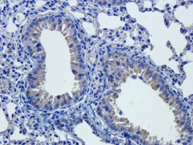 COL2A1 antibody