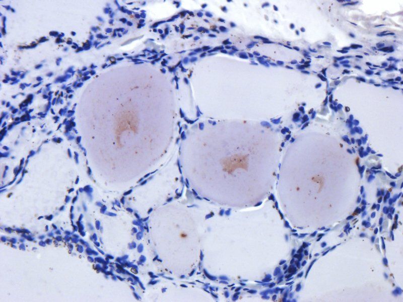 COL2A1 antibody