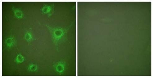 Collagen II Antibody
