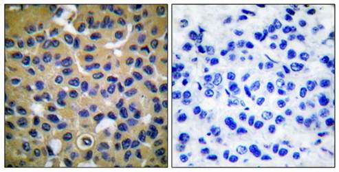 Collagen II Antibody