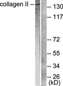 Collagen II Antibody