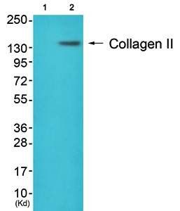 Collagen II Antibody