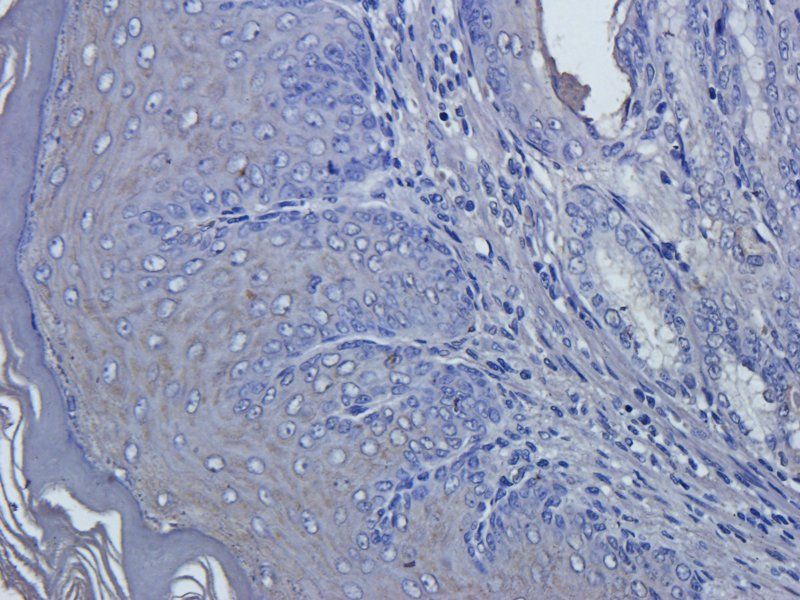 Collagen III antibody