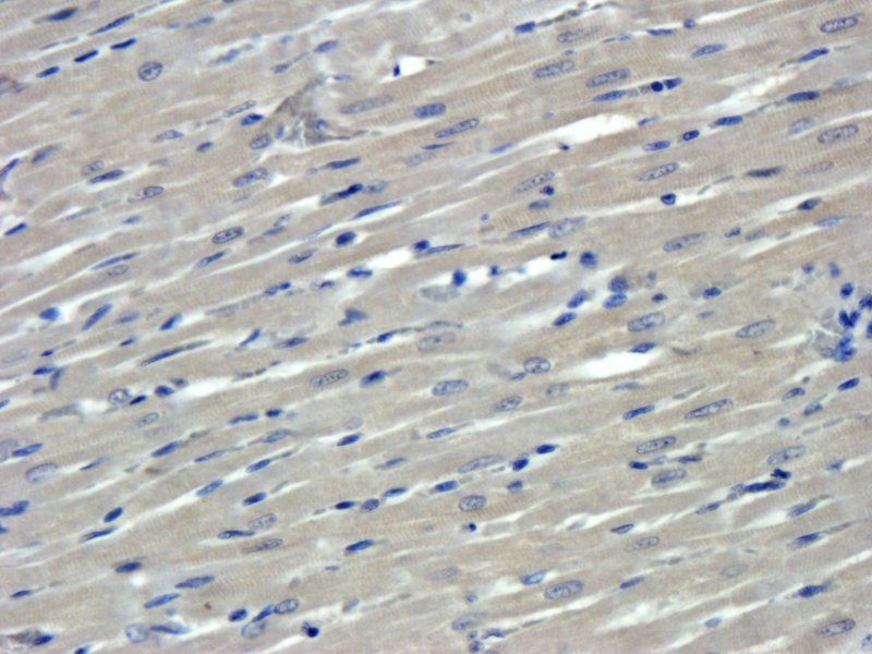 Collagen IV antibody