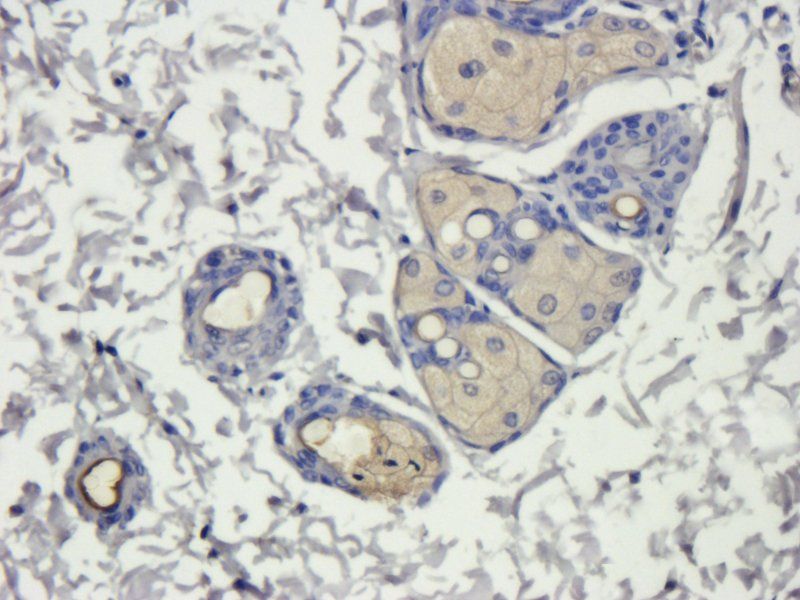 Collagen IV antibody