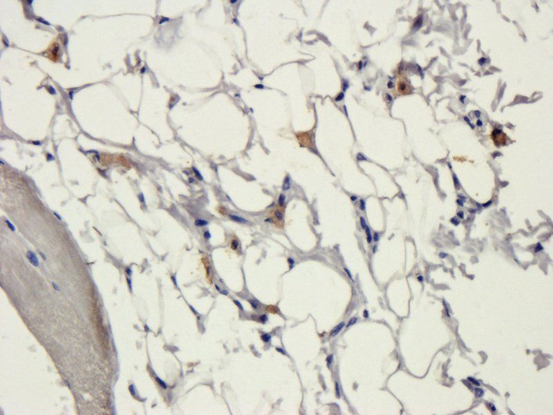 Collagen IV antibody