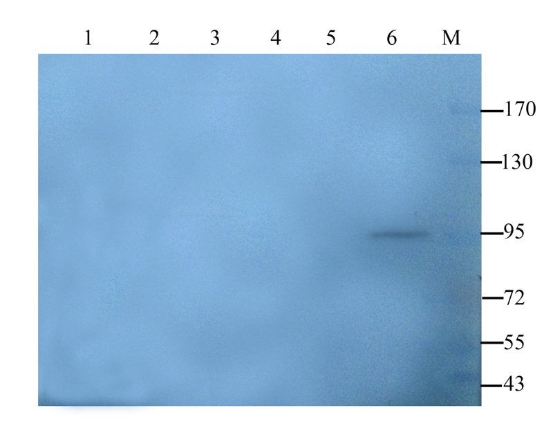 Collagen IV antibody