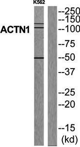 ACTN1 Antibody