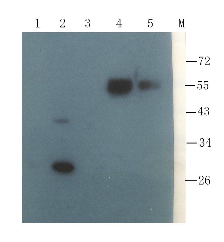 Collagen X antibody