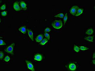 Collagenase 3 antibody