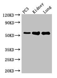 Collagenase 3 antibody