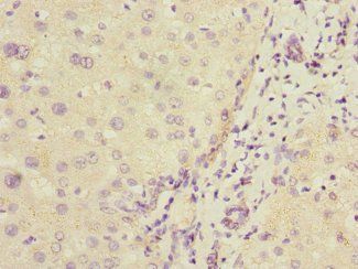 COMMD1 Antibody