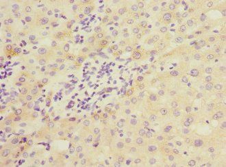 COMMD1 Antibody