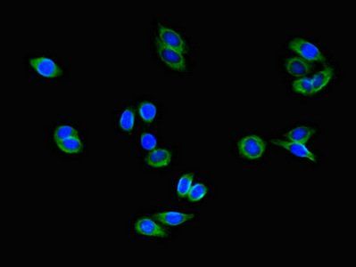 COMMD1 antibody