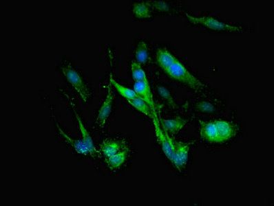 Complement alpha 2 Macroglobulin antibody