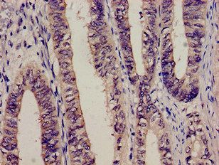 Complement alpha 2 Macroglobulin antibody