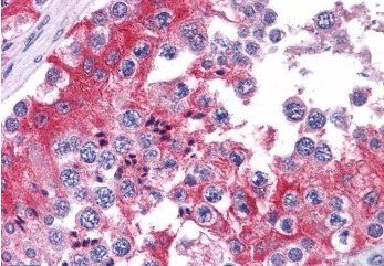 Goat anti-COMT (internal) Antibody