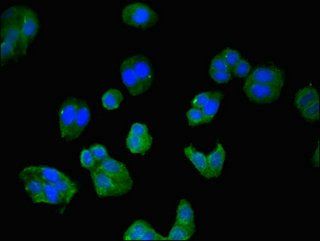 Connective tissue growth factor antibody