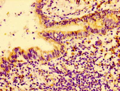 Connective tissue growth factor antibody