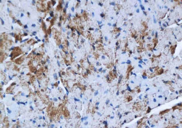 GJB3 Rabbit Polyclonal Antibody