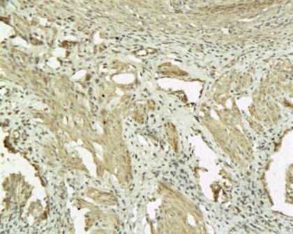 Connexin 26 Rabbit Polyclonal Antibody