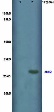 Connexin 26 Rabbit Polyclonal Antibody