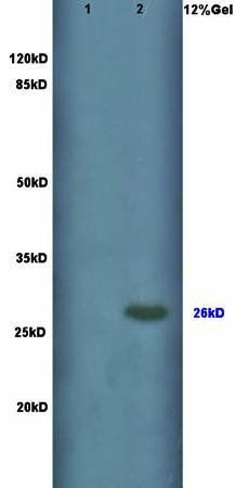 Connexin 26 antibody