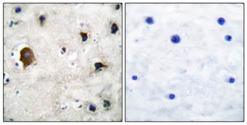 Connexin 43 Antibody