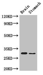 COPS7B Antibody