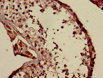 COQ6 Antibody